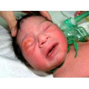 İNSANI ŞOK EDEN BİR BEBEK VAHŞETİ