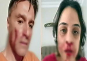 Canlı Yayında Dayak Yüzleşmesi