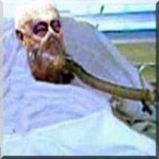 KASAP ŞARON 4 YILDIR KOMA DA