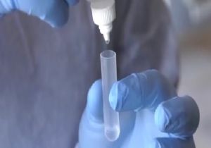  Türkiye de 36 Bin Hayalet Taşıyıcı Var 