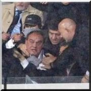 BEŞİKTAŞ TA GÖZ ALTILAR