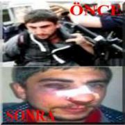  POLİS DAYAĞI YİYEN ÖĞRENCİLER İÇİN İLGİNÇ YORUM!