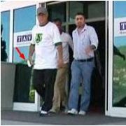 TERİM İN BODRUM DA KOPAN PARMAĞI İSTANBULDA DİKİLDİ