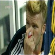 BECKHAM IN GİZLİ HASTALIĞI!