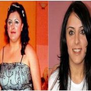 42 KİLO BİRDEN ZAYIFLADI, ANNESİ BİLE TANIYAMADI