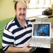 PROF.DR. TÜRK E GÖRE TÜRKİYE NİN YÜZDE 90 I HASTA