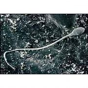 LABARATUVAR ÜRÜNÜ SPERM