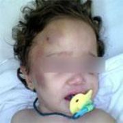 TALİHSİZ BEBEK YİNE HASTANEYE KALDIRILDI