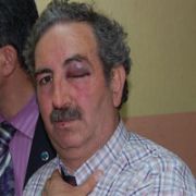 VELİ DAYAĞI, ÖĞRETMENİ BU HALE GETİRDİ