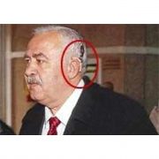 İBRAHİM ŞAHİN NE BİYONİK KULAK!