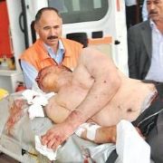  BİRİ TUTTU, DİĞERİ KESTİ 