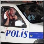 EMNİYET MÜDÜRÜ NÜN KAFASINDA ŞİŞE KIRDILAR