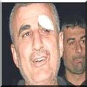 BAŞKANA ÇÖP DAYAĞI
