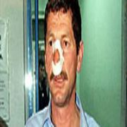CHP Lİ ADAYIN BURNUNU KIRDILAR