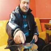 PARMAĞIYLA TÜP YAKAN ADAM!